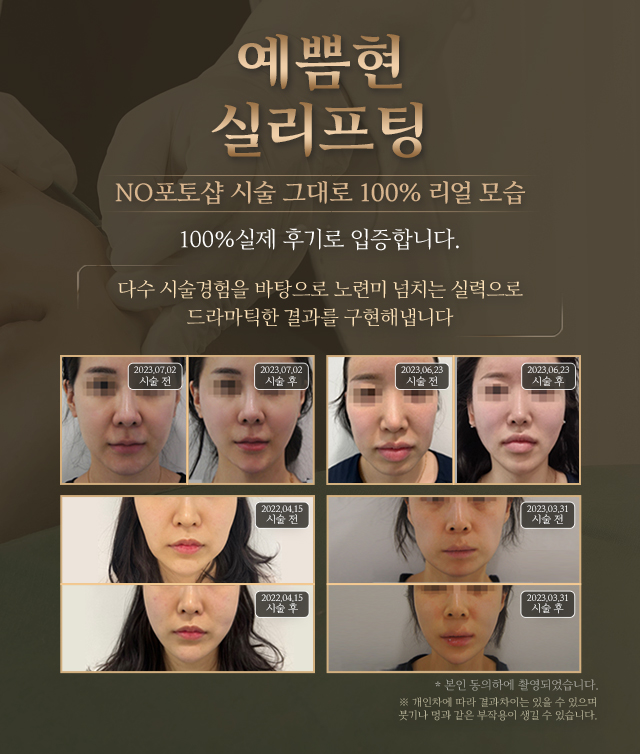 예쁨현 실리프팅의 특별함