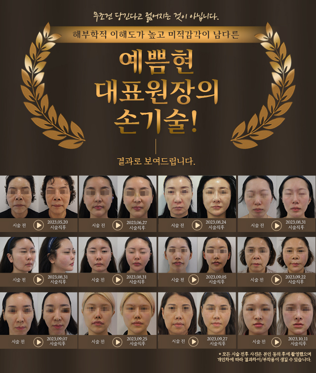 예쁨현 대표원장의 손기술