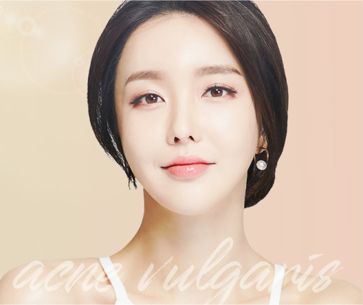 여드름 프로그램